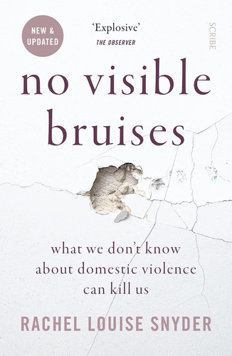 Visible bruises what - no, bruises: